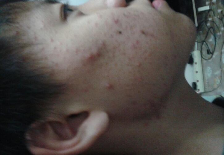 长期熬夜对男性的危害(图4) 长期熬夜对男性的危害(图4)